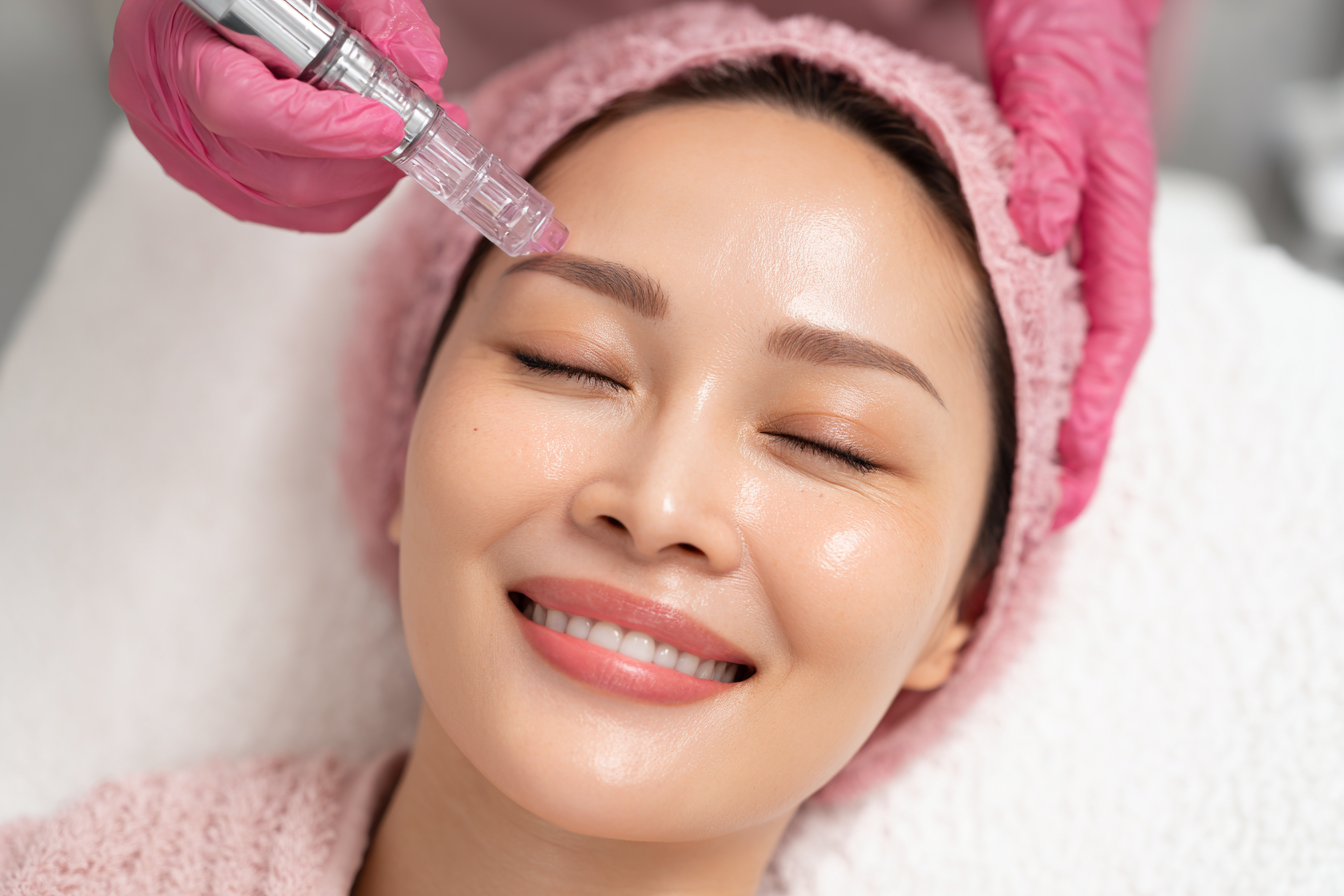 Microneedling